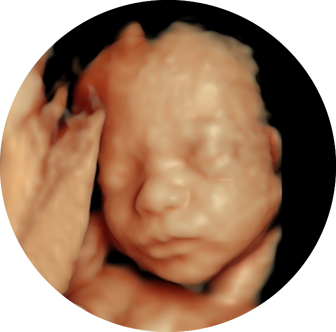 3D and 4D scan 3D and 4D scan