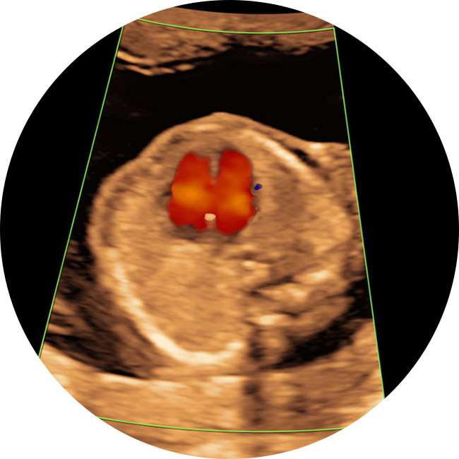 Gennemscanning Gennemscanning