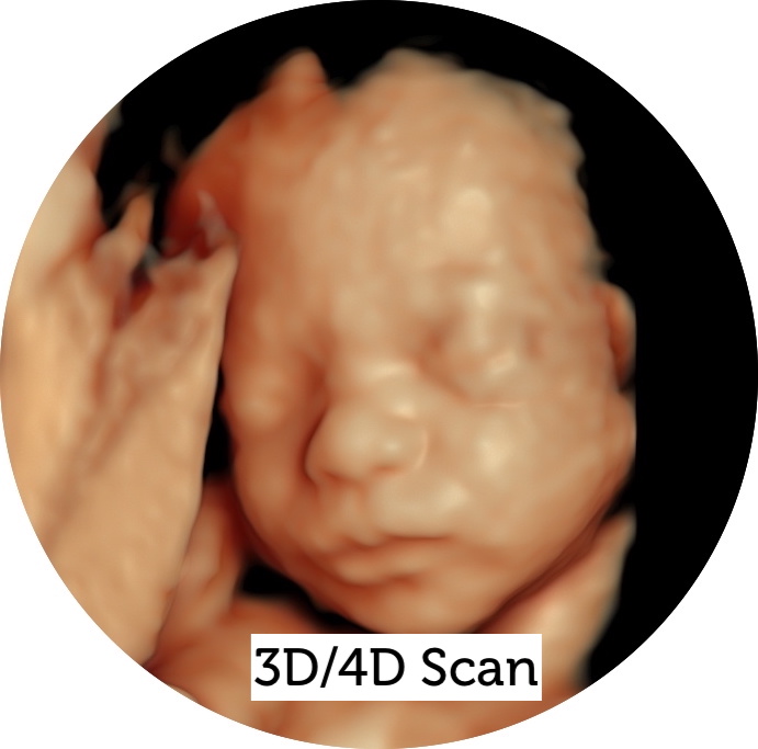 3D/4D Scan