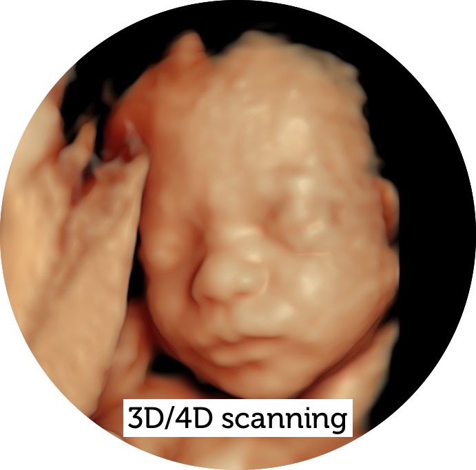 3D/4D scanning