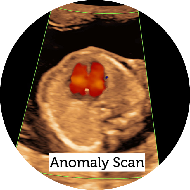 Anomaly Scan