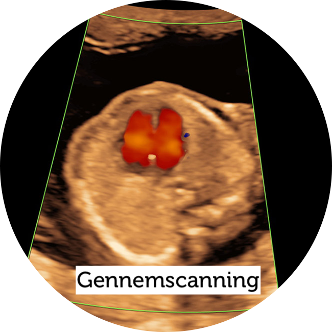 Gennemscanning