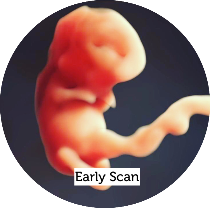 Early Scan