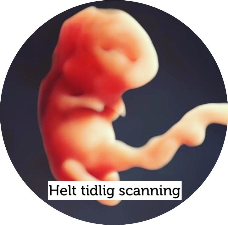 Helt tidlig scanning