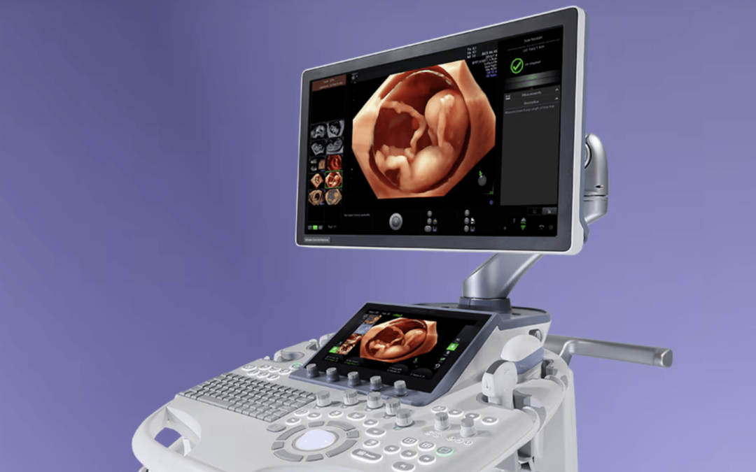 What are 2D and 3D/4D scans?