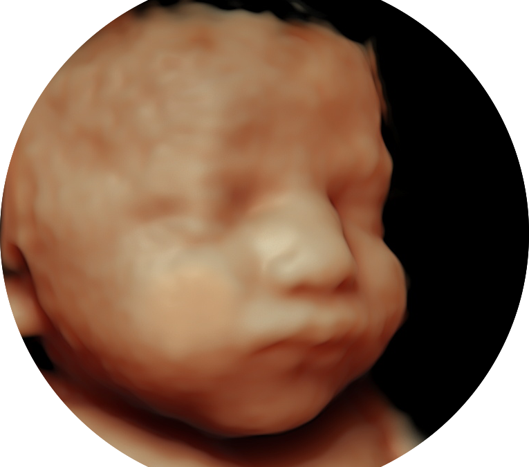 3D/4D Scan